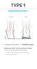 Arches Insoles Type 1 - Pronation/Flat Feet